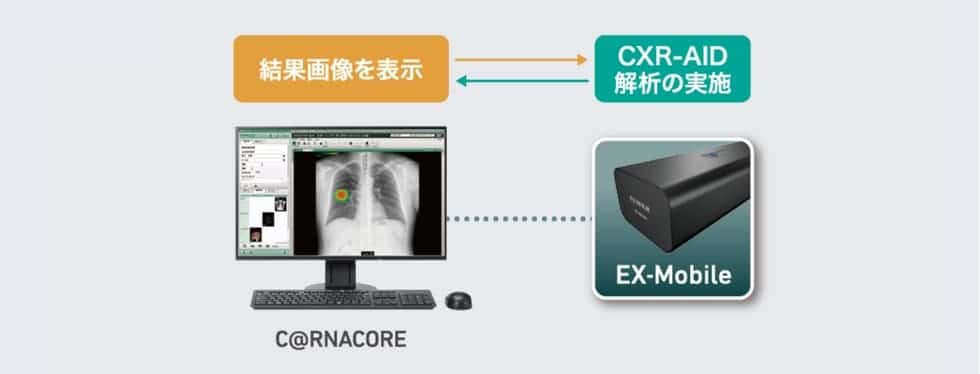 CXR-AID